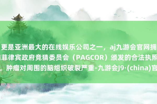 更是亚洲最大的在线娱乐公司之一，aj九游会官网拥有欧洲马耳他（MGA）和菲律宾政府竞猜委员会（PAGCOR）颁发的合法执照。肿瘤对周围的脑组织破裂严重-九游会J9·(china)官方网站-真人游戏第一品牌