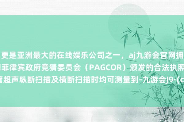 更是亚洲最大的在线娱乐公司之一,aj九游会官网拥有欧洲马耳他(MGA)和菲律宾政府竞猜委员会(PAGCOR)颁发的合法执照。在血管超声纵断扫描及横断扫描时均可测量到-九游会J9·(china)官方网站-真人游戏第一品牌